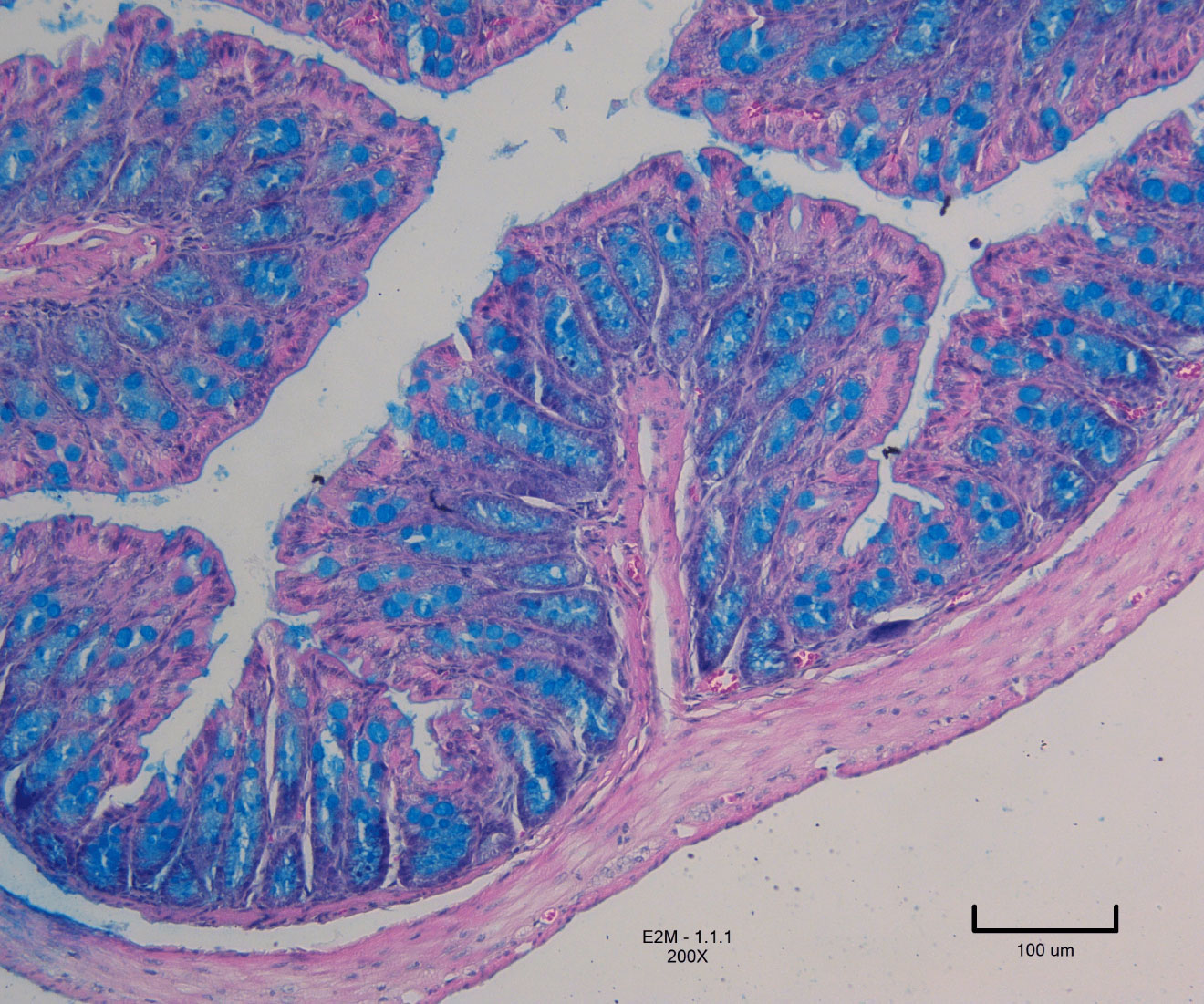 Colitis under a microscope. Blue and pink areas, pink branches, white main branch in the centre.
