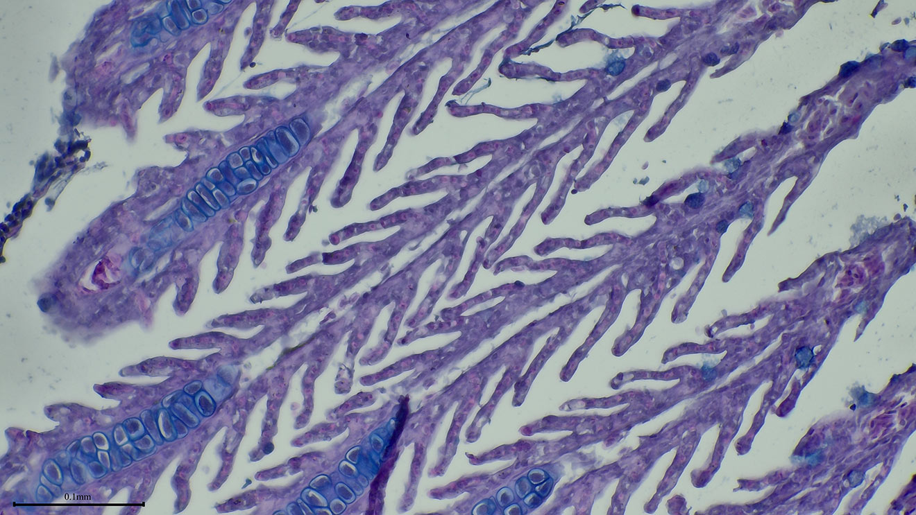 A microscopic image of diagonally arranged, purple-stained tissue with branching finger-like projections and oval, blue cells within the tips.