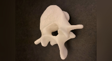 A 3D printed spinal bone against a black canvas