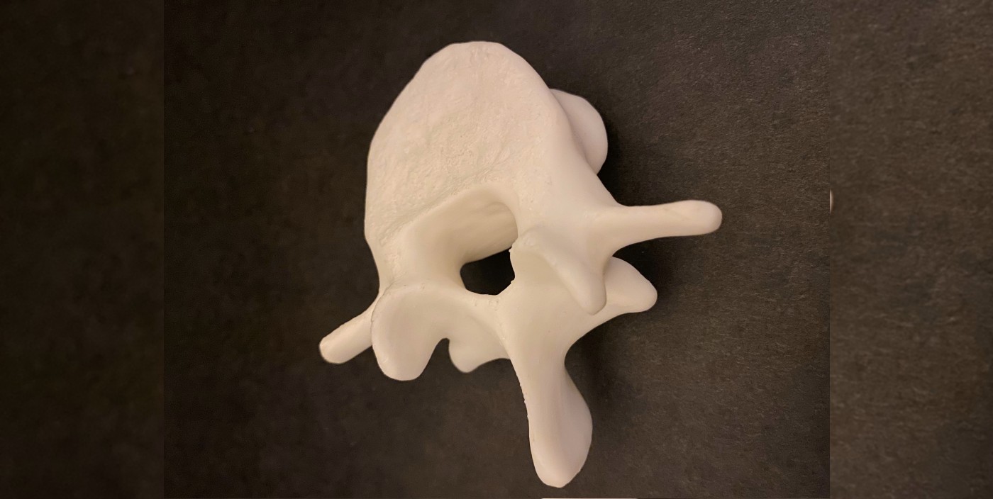 A 3D printed spinal bone against a black canvas